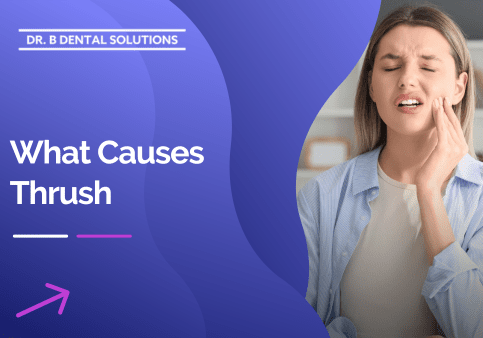 What Causes Thrush. - Dr. B Dental Solutions