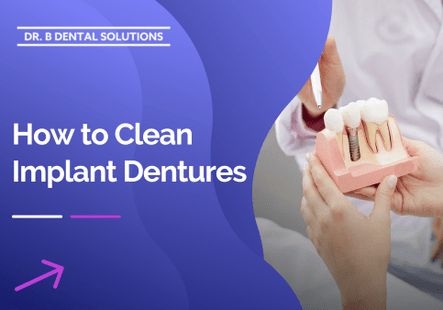 How to Clean Implant Dentures. - Dr. B Dental Solutions