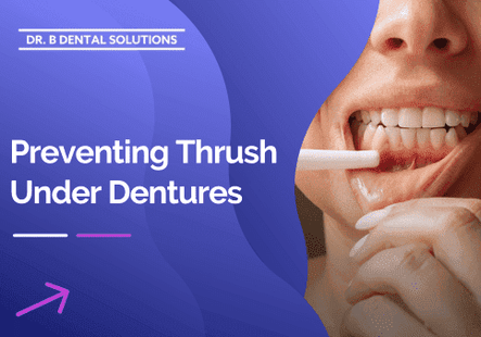 Preventing Thrush Under Dentures. - Dr. B Dental Solutions