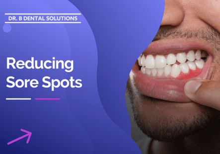 Reducing Sore Spots. - Dr. B Dental Solutions