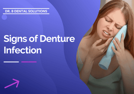 Signs of Denture Infection. - Dr. B Dental Solutions