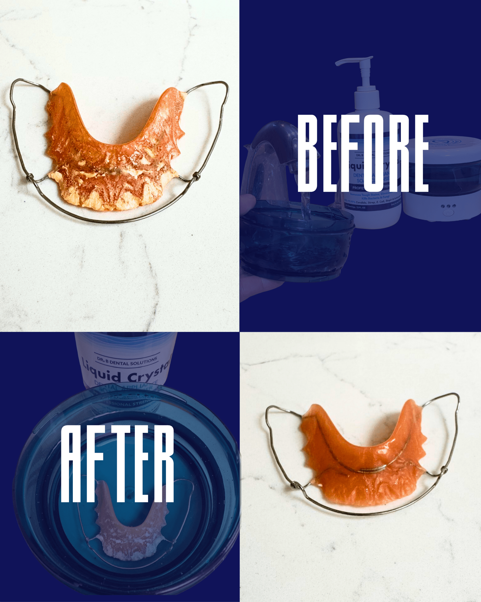 Dental Appliance Kit - Dr. B Dental SolutionsDental Appliance Kit2977Dr B Dental SolutionsL - APPKITLiquid - Dental Appliance KitDental Appliance Kit