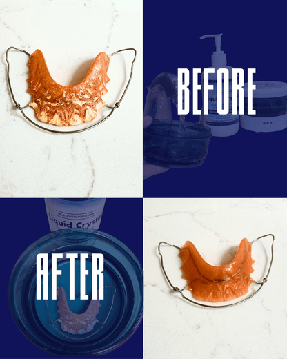 Dental Appliance Kit - Dr. B Dental SolutionsDental Appliance Kit2977Dr B Dental SolutionsL - APPKITLiquid - Dental Appliance KitDental Appliance Kit